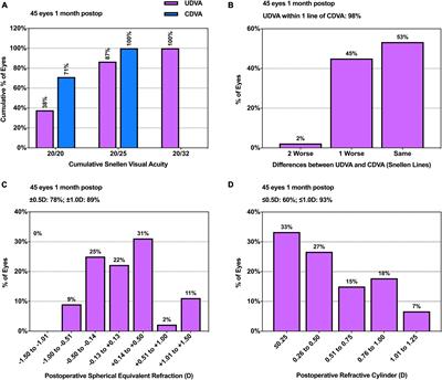 The impact of corneal higher-order aberrations on dynamic visual acuity post cataract surgery